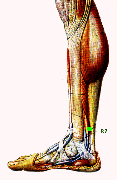 green disc on medial sural nerve