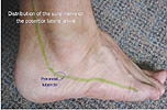 sural nerve in green